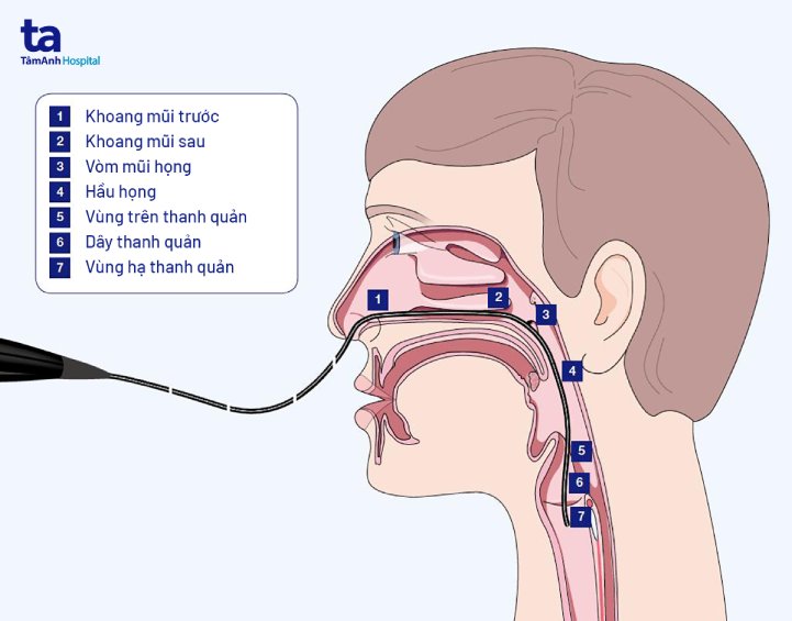 nội soi thanh quản trực tiếp bằng ống mềm