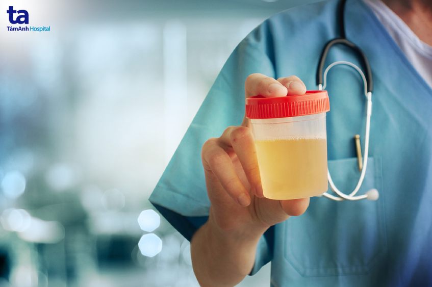 quy trình siêu âm bàng quang