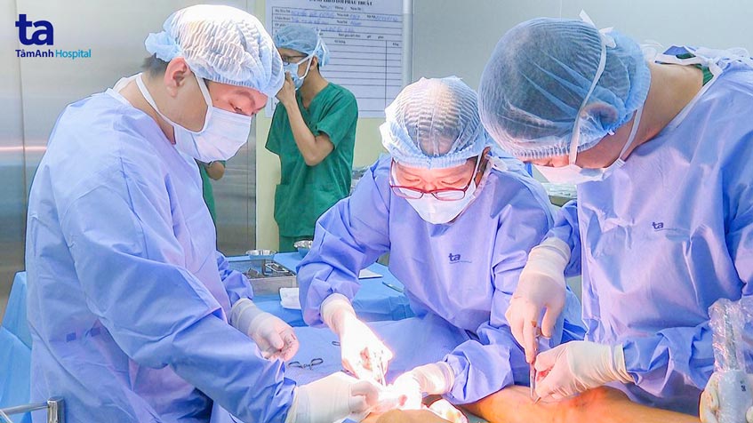 tiến hành đốt laser