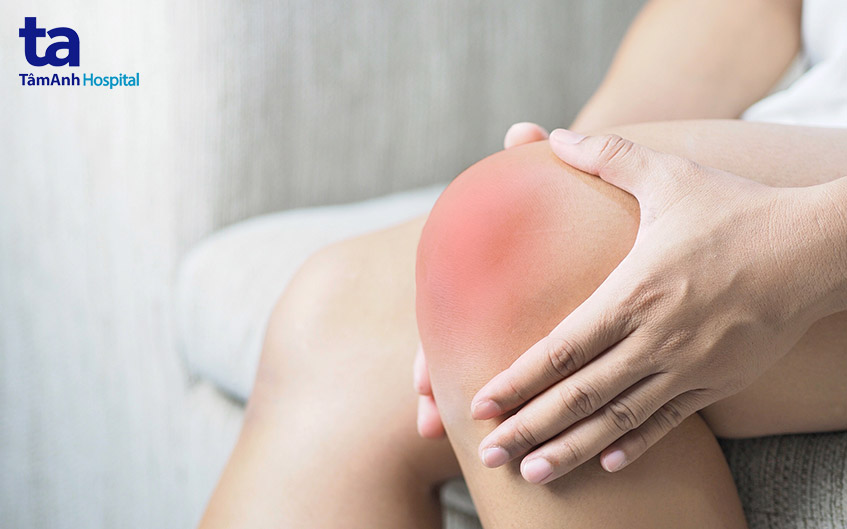 triệu chứng đau đầu gối thường gặp