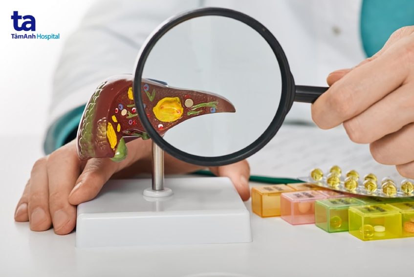 triệu chứng xơ gan giai đoạn đầu