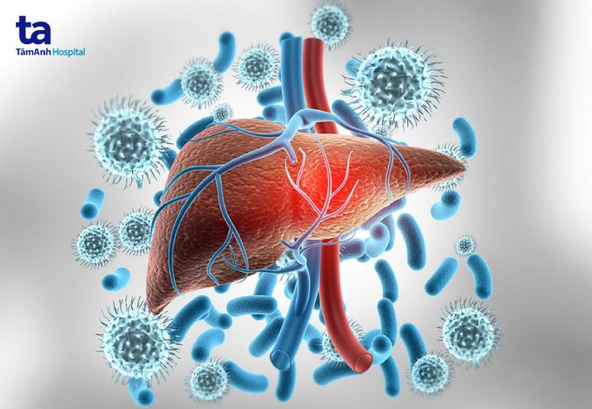tỷ lệ mắc ung thư gan do xơ gan