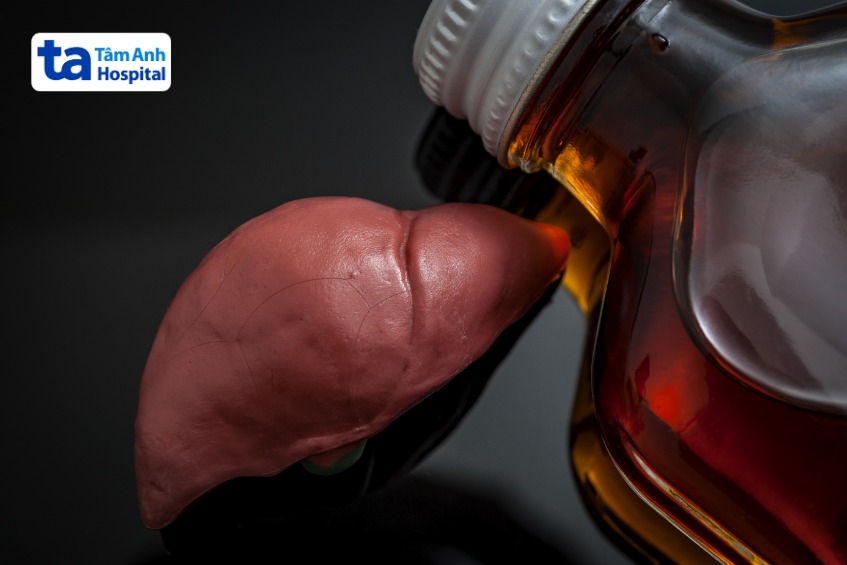 viêm gan mạn do rượu