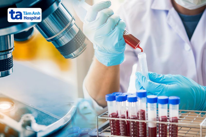 xét nghiệm viêm gan do rượu