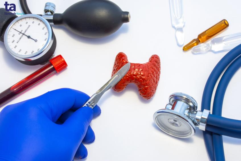 bướu cổ ảnh hưởng đến sức khỏe như thế nào