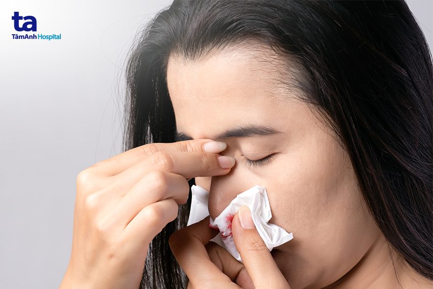 chỉ định nội soi mũi