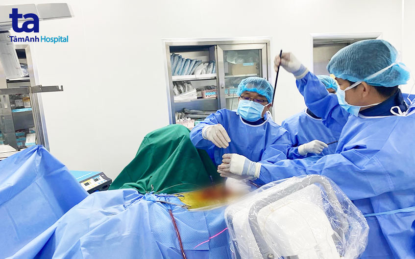 chỉ định phẫu thuật