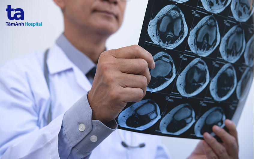 chụp x quang chẩn đoán