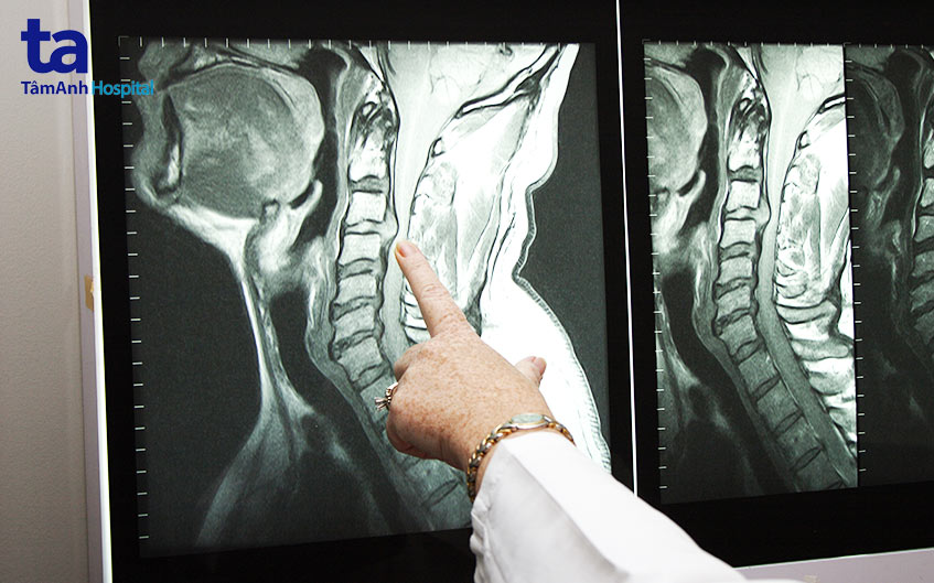 dấu hiệu tăng theo cấp độ