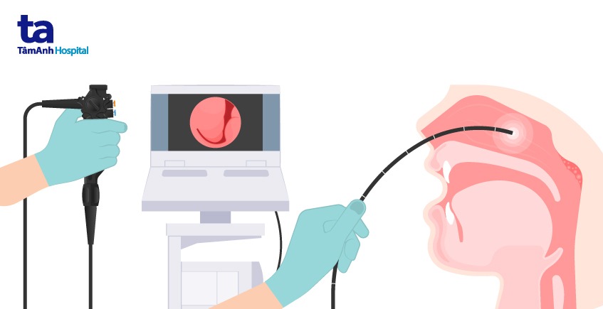 hình ảnh nội soi mũi