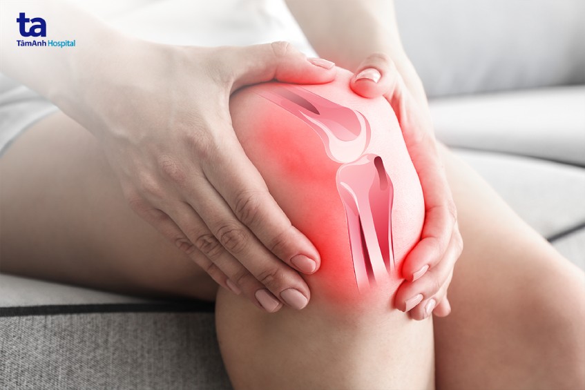 khi nào cần siêu âm khớp gối