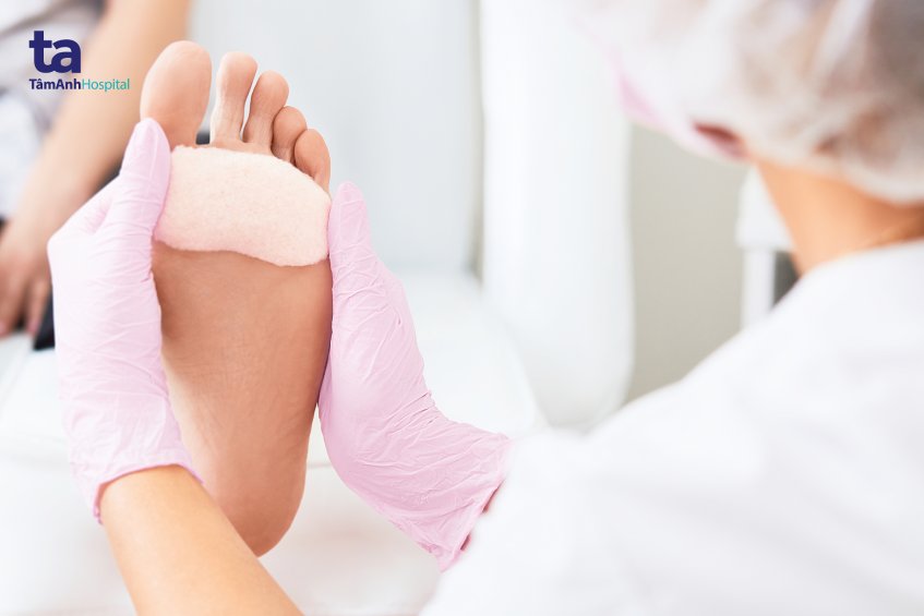 không kiểm soát tốt đường huyết dễ loét bàn chân