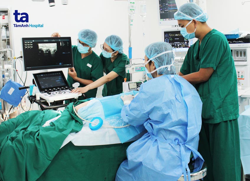 kỹ thuật eps
