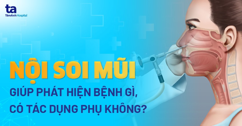 phương pháp nội soi mũi