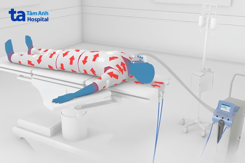 mô phỏng máy hạ thân nhiệt