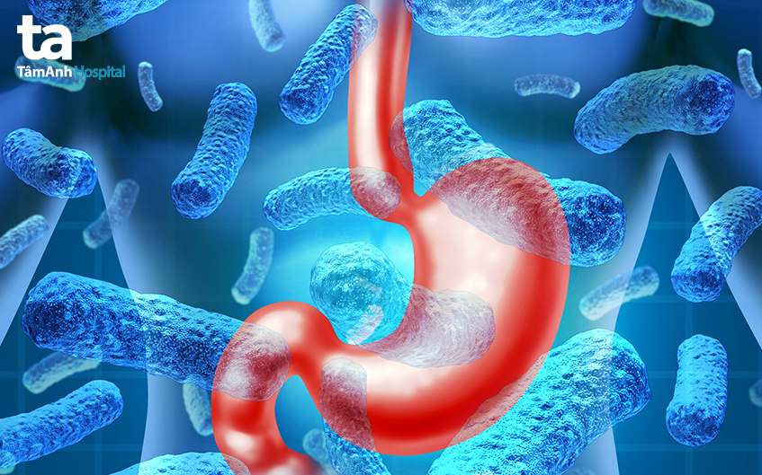 nguyên nhân viêm dạ dày cấp