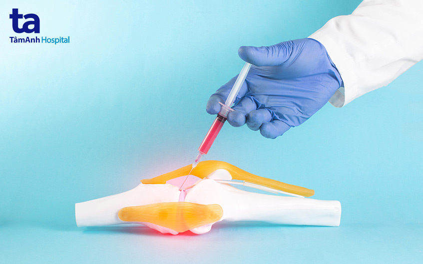 phương pháp tiêm cortisone