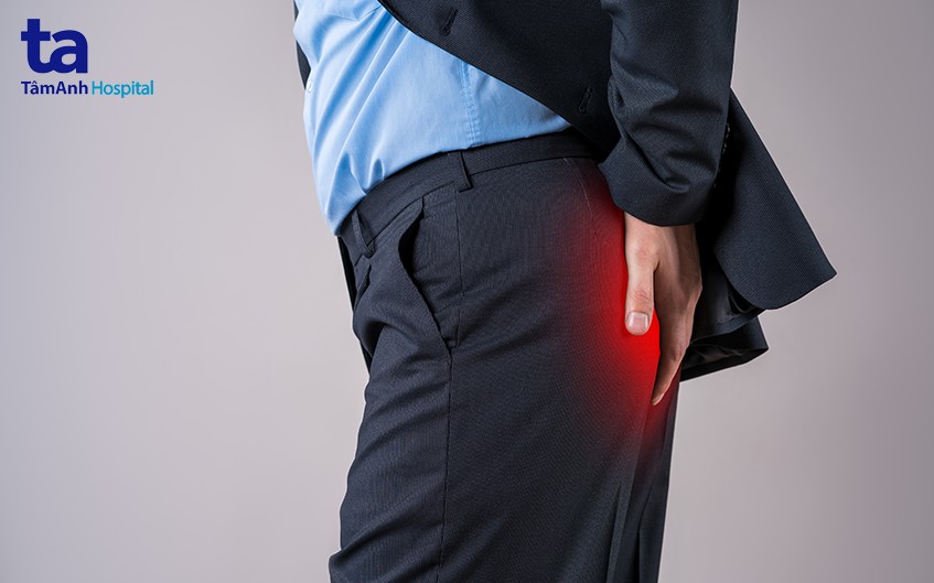 polyp ở hậu môn