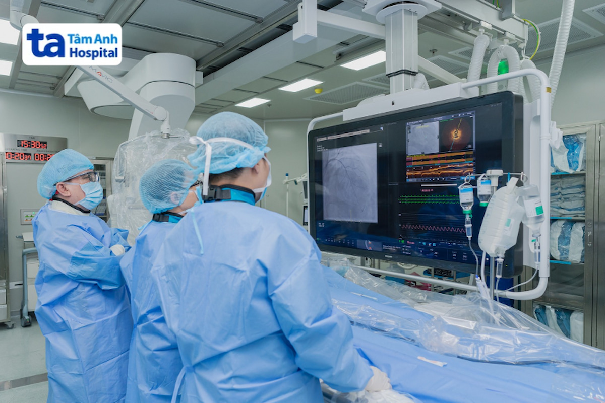 quy trình đặt stent mạch vành
