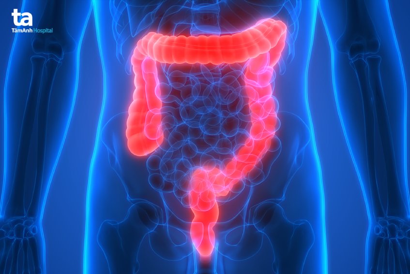 quy trình siêu âm đại tràng