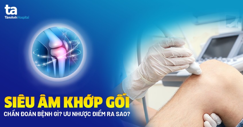 quy trình siêu âm khớp gối