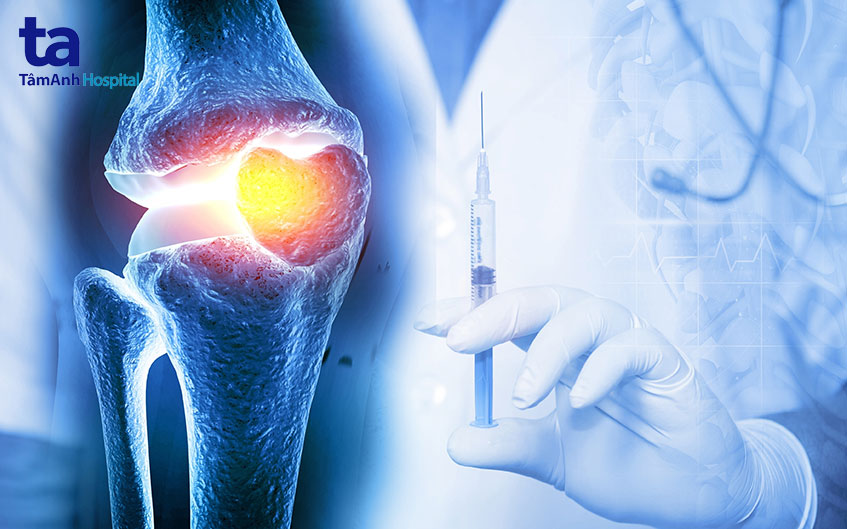 tiêm collagen vào khớp là gì