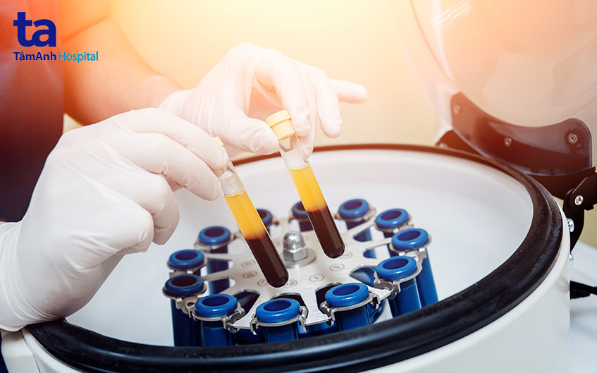 tiêm huyết tương giàu tiểu cầu vào gân