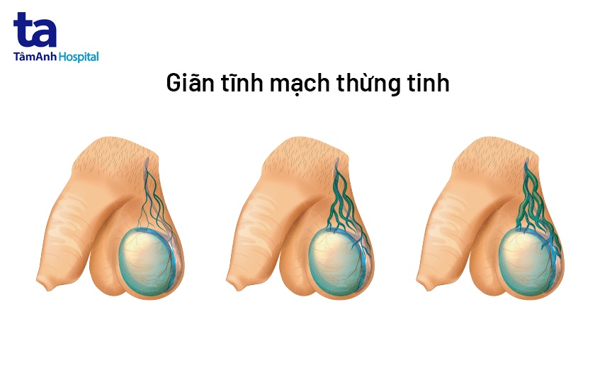 tổng quan về bệnh