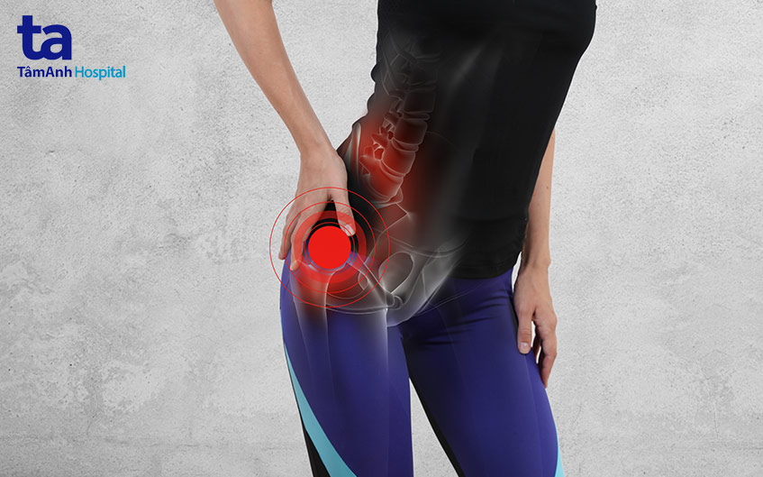 triệu chứng khớp háng bị hẹp