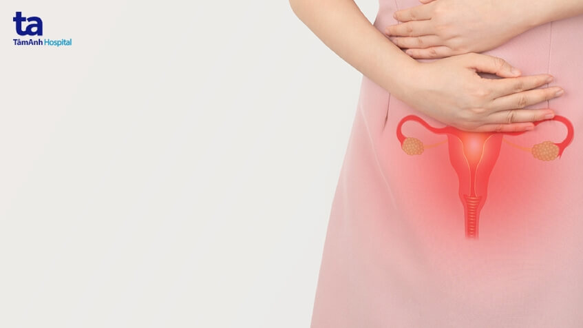 ung thư cổ tử cung có mấy giai đoạn