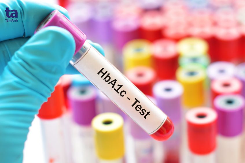 xét nghiệm hba1c cho thấy thêm cường độ lối huyết trung bình