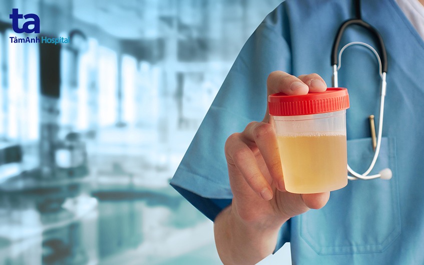 xét nghiệm nước tiểu