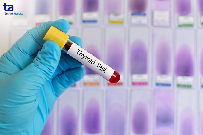 xét nghiệm xác định nồng độ hormone trong máu