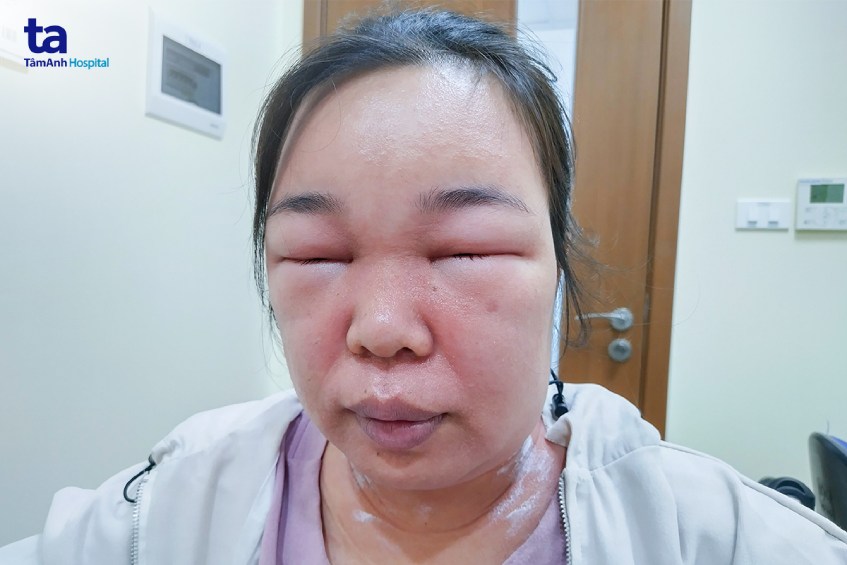 ảnh bệnh nhân 1