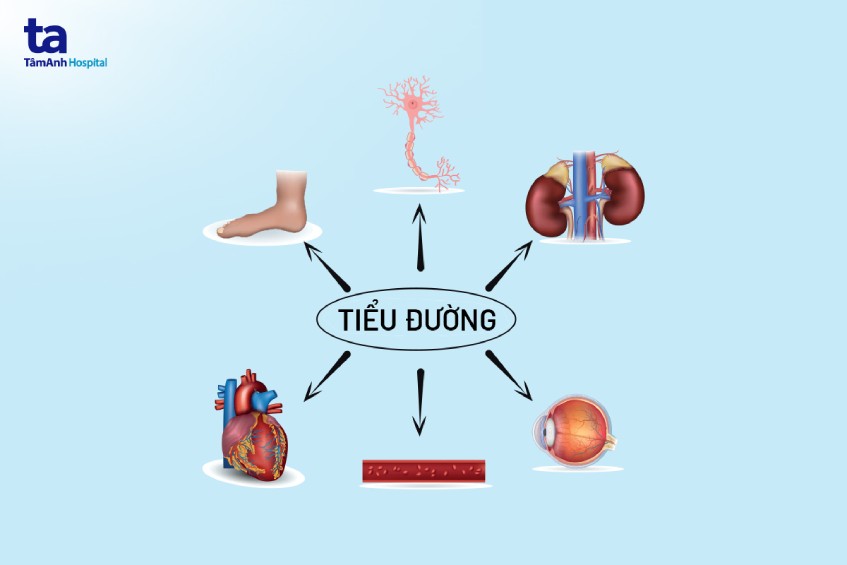 bệnh tiểu đường tuýp 2 kéo dài suốt đời