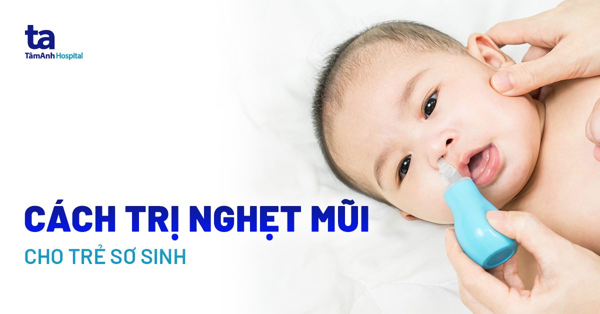 Top 4 Cách trị nghẹt mũi cho trẻ sơ sinh hiệu quả