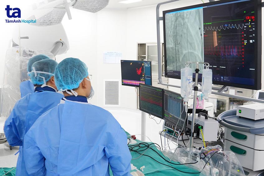 can thiệp đốt cơn rung nhĩ