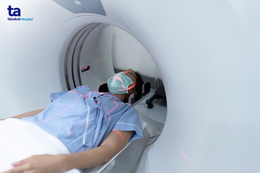 chi phí chụp ct tầm soát đột quỵ não