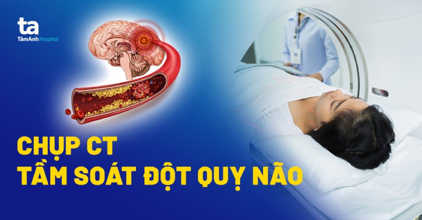 chụp ct chẩn đoán đột quỵ