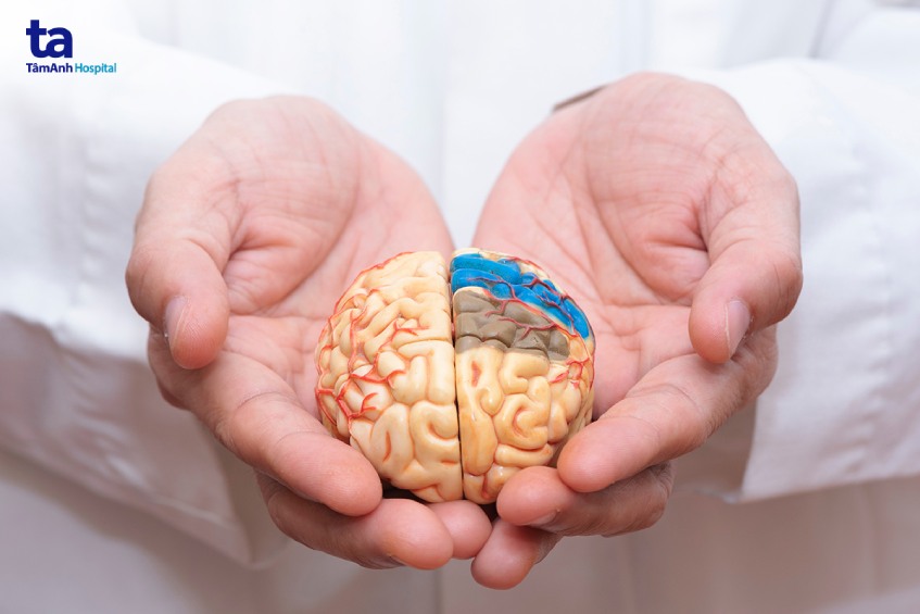 ct đột quỵ não