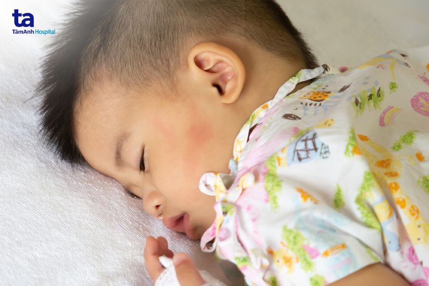 điều trị tại cơ sở y tế