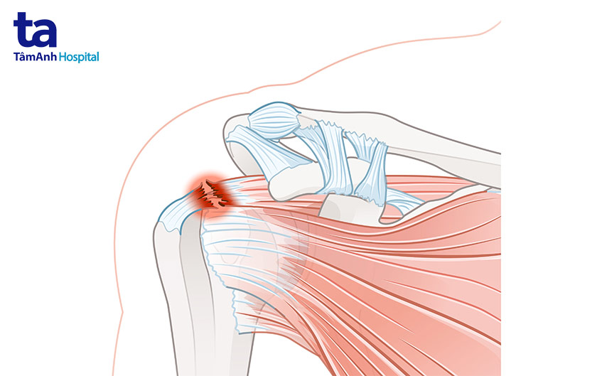 động tác vung tay qua đầu