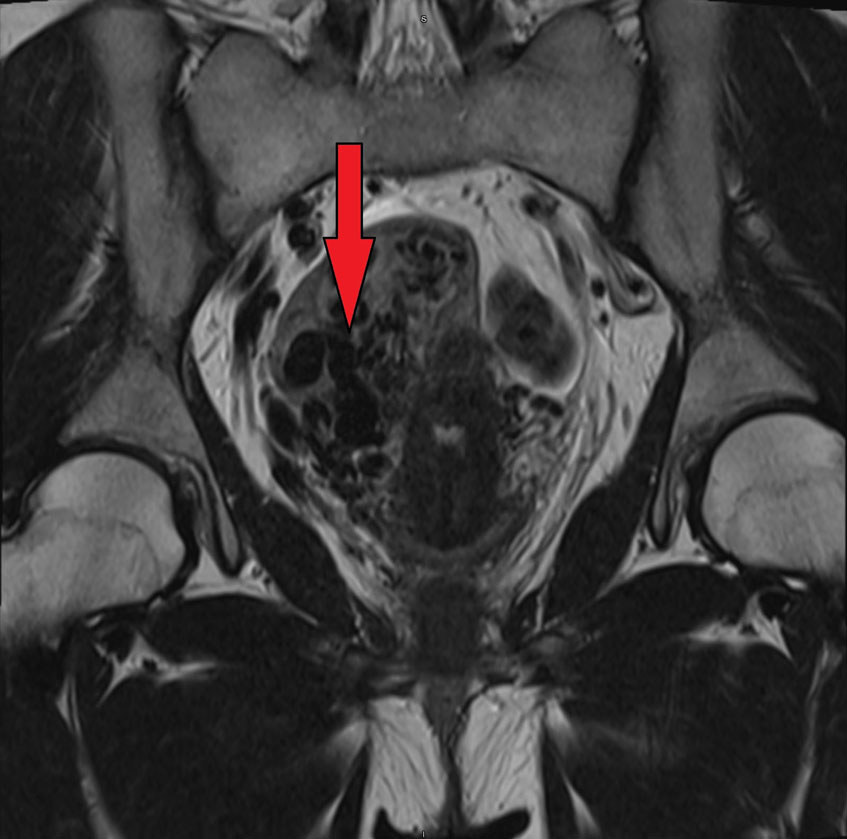 hình chụp u quái