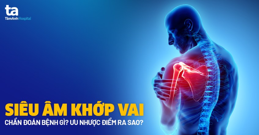 kỹ thuật siêu âm khớp vai