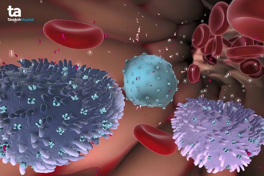 mô phỏng bệnh u tủy sống