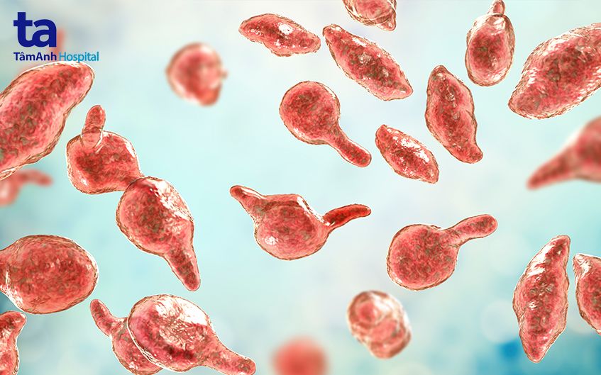 viêm tuyến tiền liệt mạn tính do vi khuẩn