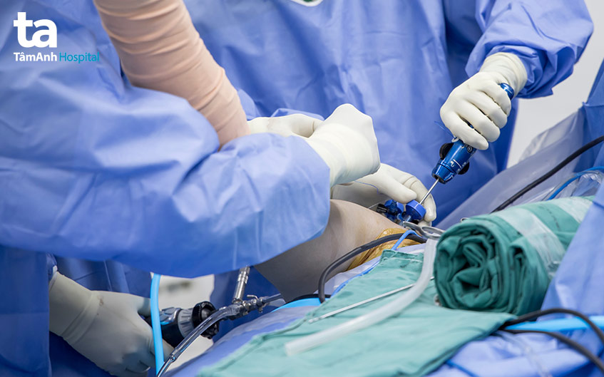 phẫu thuật cơ trên gai