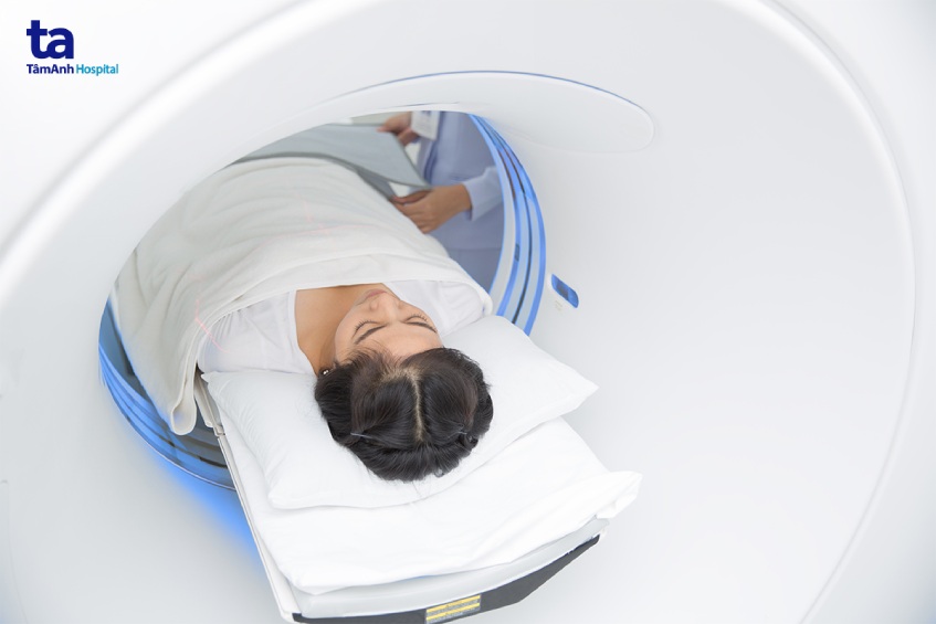 quy trình ct tầm soát đột quỵ não
