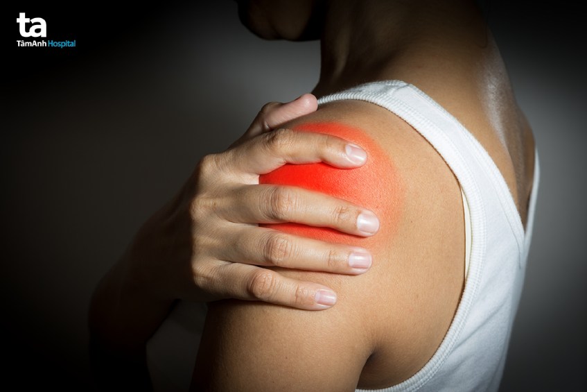 siêu âm khớp vai chẩn đoán bệnh gì