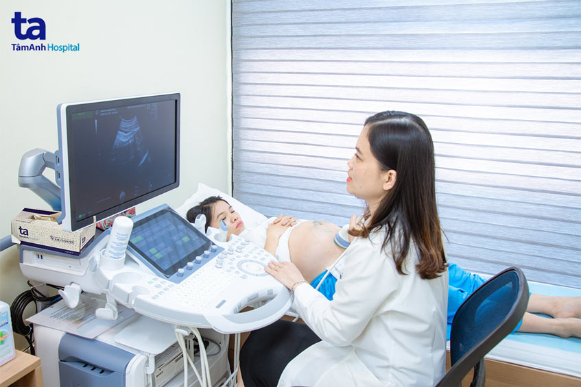 siêu âm màu doppler